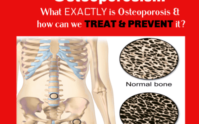 Osteoporosis…What exactly is Osteoporosis & how can we treat & prevent it?
