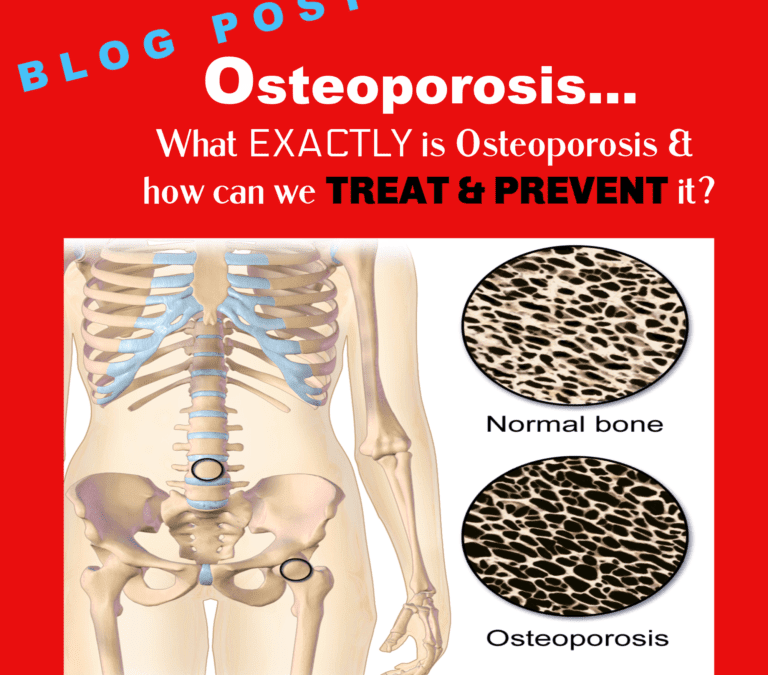 Osteoporosis…What exactly is Osteoporosis & how can we treat & prevent it?