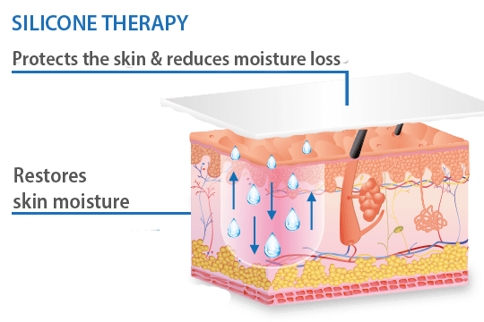 silicone therapy